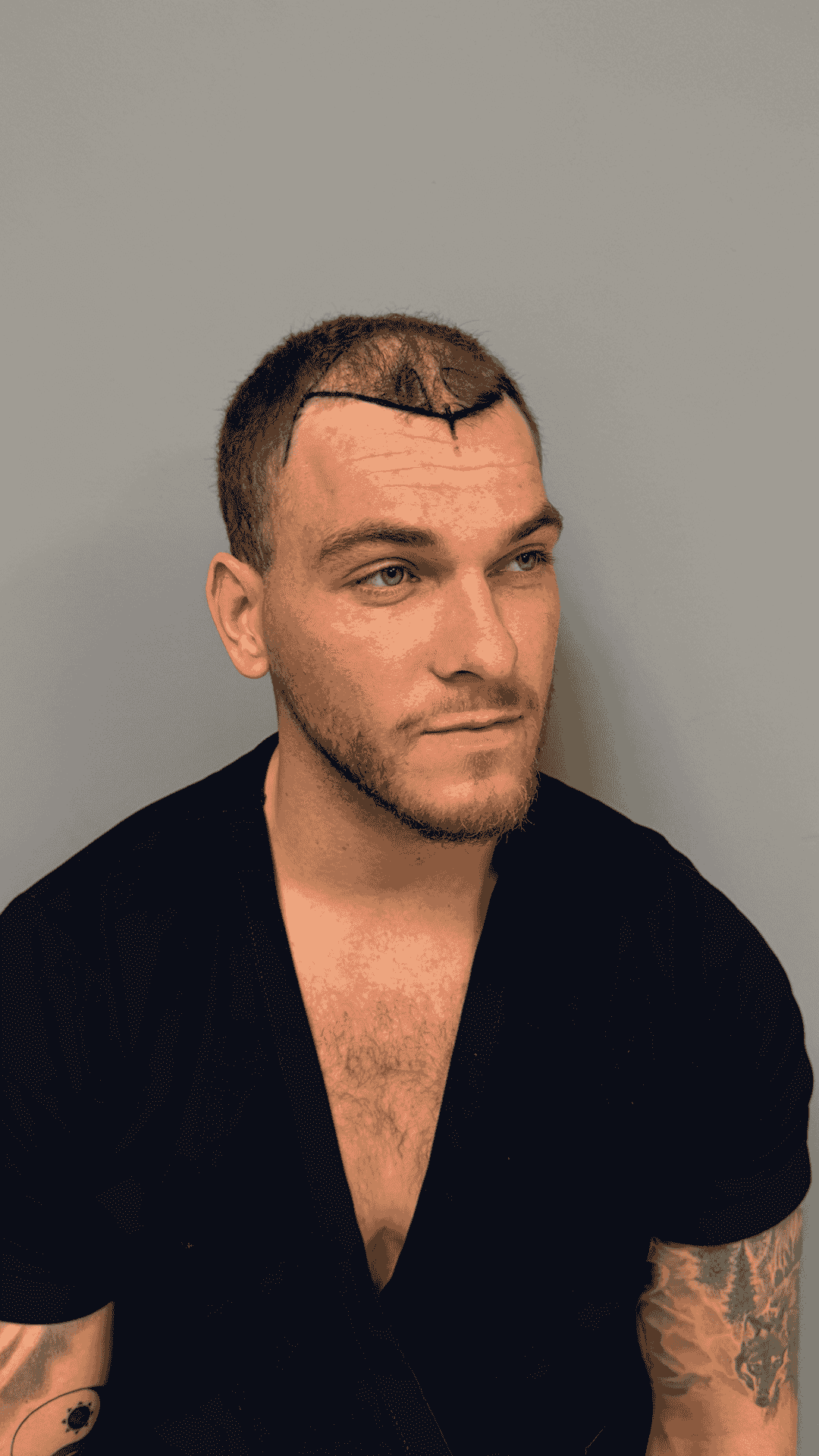 Resultat for Benjamin, 28, Aalborg - før