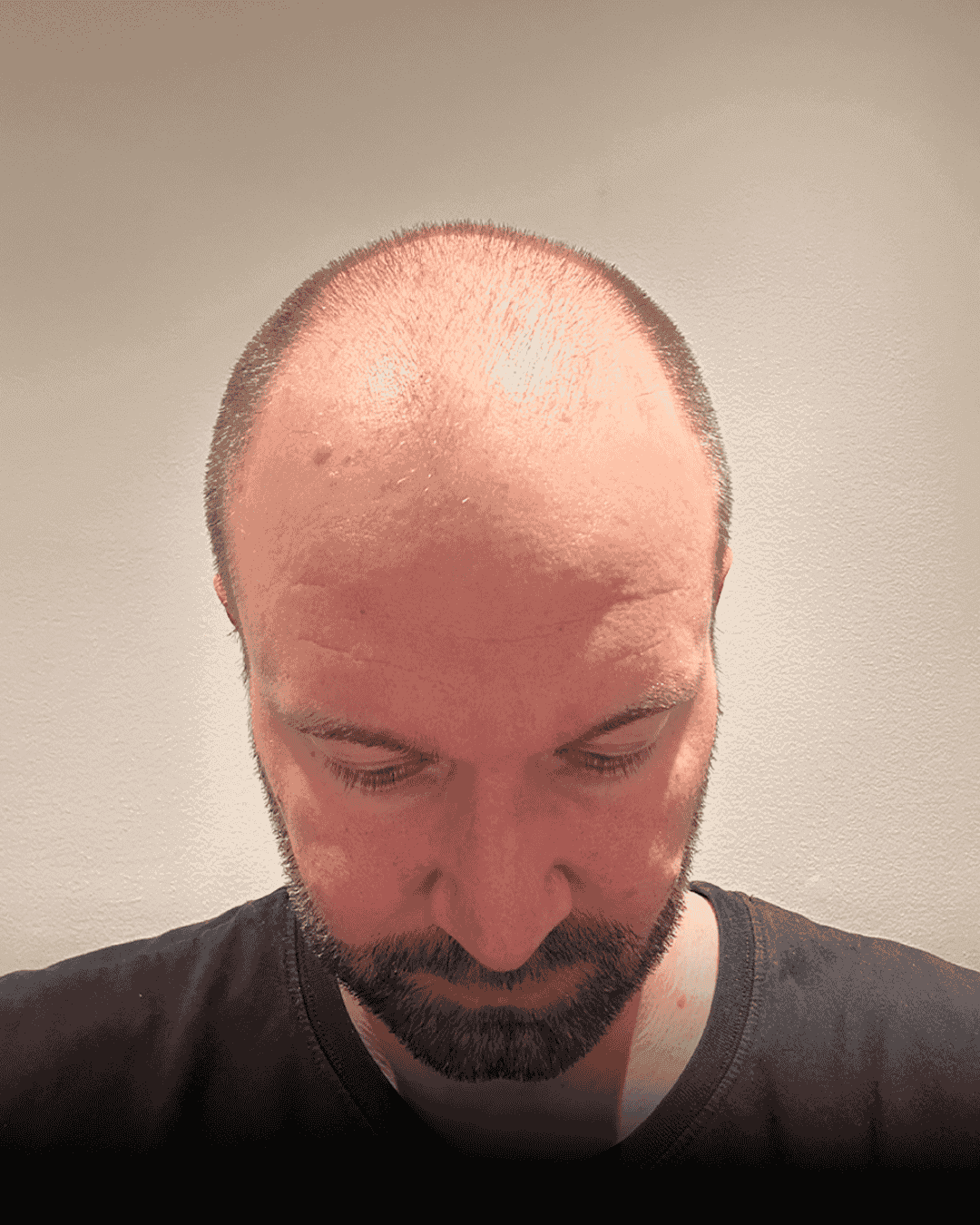 Resultat for Sebastian - før