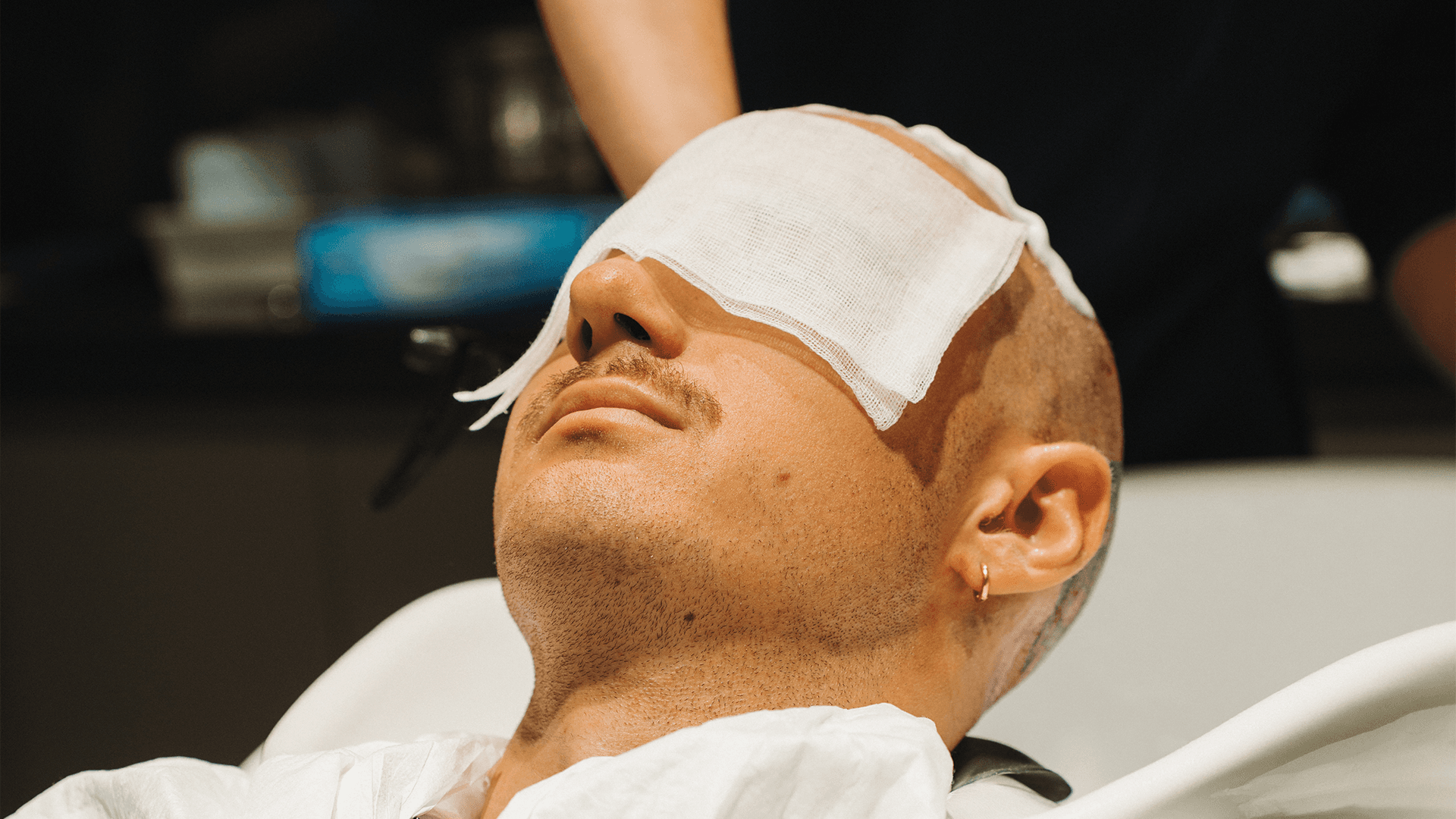 Aftercare efter hårtransplantation